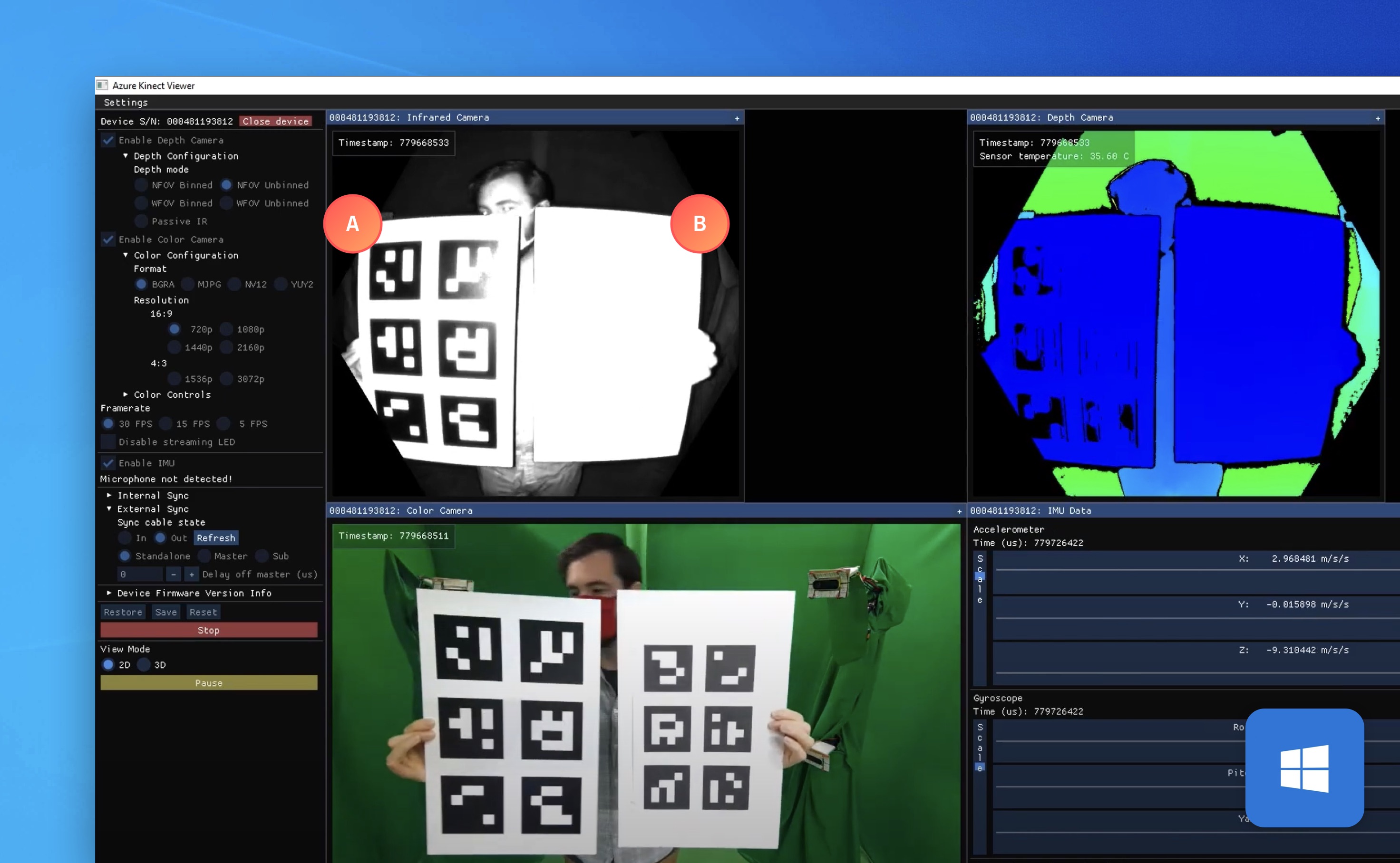 A properly-printed chart (A) and an improperly-printed chart (B) as seen in the Azure Kinect's SDK Kinect Viewer. A proper chart (A) appears in high-contrast in the infrared camera.
